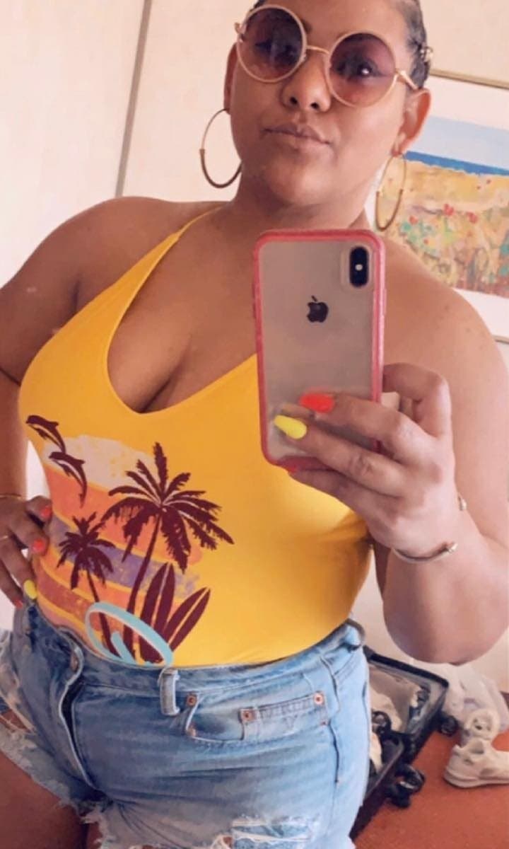 Before Medical Weight Loss